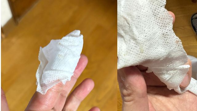 出血が無くなってきた