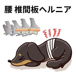 腰|椎間板ヘルニア
